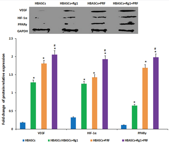 The protein expression of PPAR&#x03B3;, HIF-1&#x03B1;, and VEGF were much higher in neogenetic adipose tissue of group D than in the other three groups, and had a reasonably higher expression in the single treated groups.