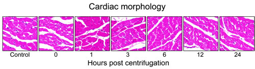 Representative photomicrographs of tissue sections obtained from hypergravity-exposed hearts.