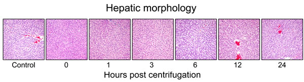 Representative photomicrographs of tissue sections obtained from hypergravity-exposed livers.