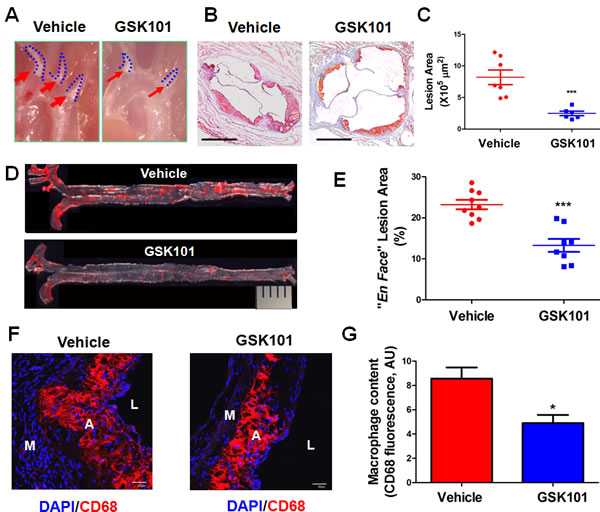 GSK1016790A attenuates the development of atherosclerotic lesions in ApoE-/- mice.