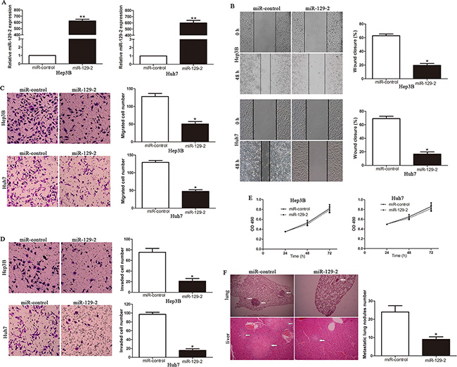 Ectopic expression of miR-129-2 ameliorates HCC migration and invasion, both in vitro and in vivo.