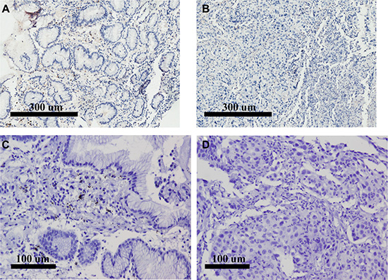 FFPE RNAscope assays using RNAscope&#x00AE; 2.0 HD Detection Kit (Brown) compared to IHC of the same samples.