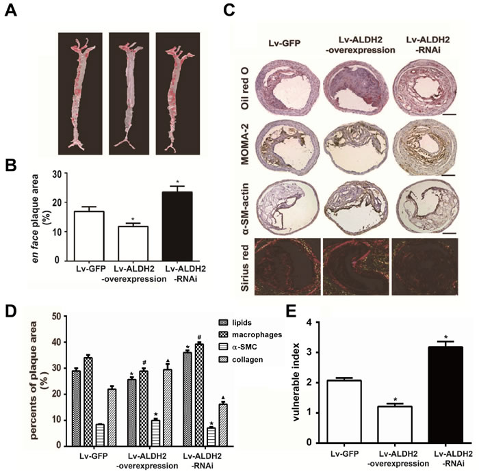 Changes of atherosclerotic plaques in aortas and carotid plaques composition in apoE-/- mice after lentivirus transfection.