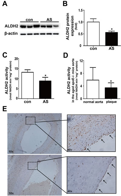 Expression and activity of ALDH2 in the vessels with or without atherosclerotic plaques.