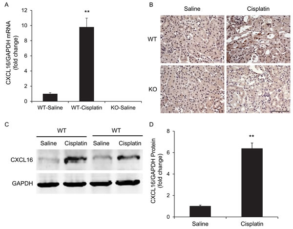 CXCL16 is upregulated in the kidney after cisplatin-induced acute kidney injury.