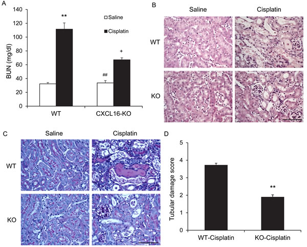 Genetic deficiency of CXCL16 protects kidney against cisplatin-induced injury.
