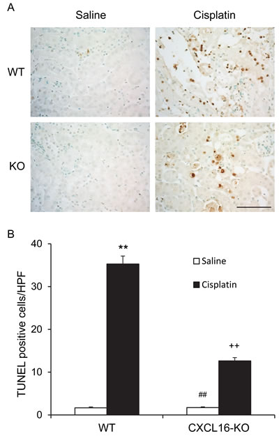 CXCL16 deficiency protects tubular epithelial cells from apoptosis in kidney of cisplatin-induced injury.