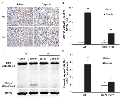 CXCL16 deficiency inhibits Caspase-3 activation in tubular epithelial cells.