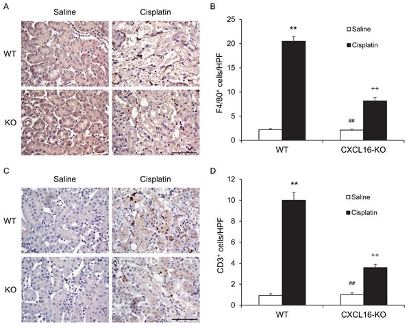 CXCL16 deficiency inhibits infiltration of macrophages and T cells in the kidney after cisplatin treatment.