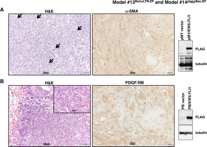 Histopathological analysis of tumors from Model #13
