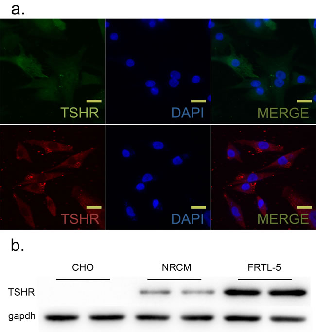 TSH receptor (TSHR) was expressed in neonatal rat ventricular myocytes (NRCM) and FRTL-5 cells.