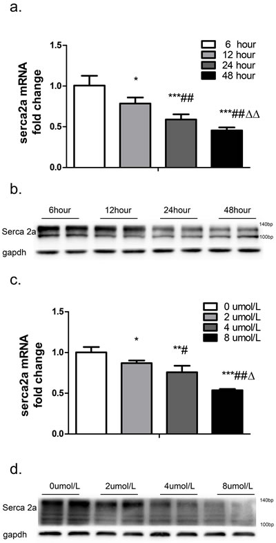 SERCA2a expression after treatment with different concentrations of TSH for different periods of time was measured in cardiomyocytes.