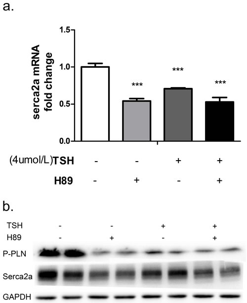 NRCMs were treated with 4 &#x3bc;M TSH and 20 &#x3bc;M H89 for 24 hours.