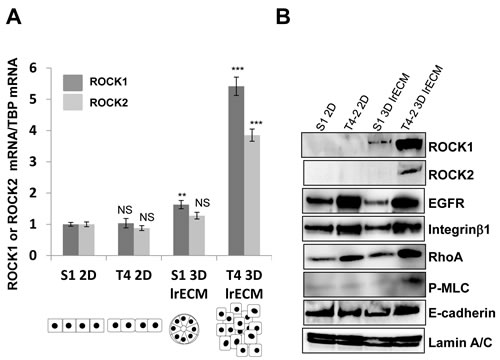 Elevated expression of ROCK1, ROCK2 and RhoA in malignant T4-2 cells in three-dimensional laminin-rich ECM (3D lrECM).