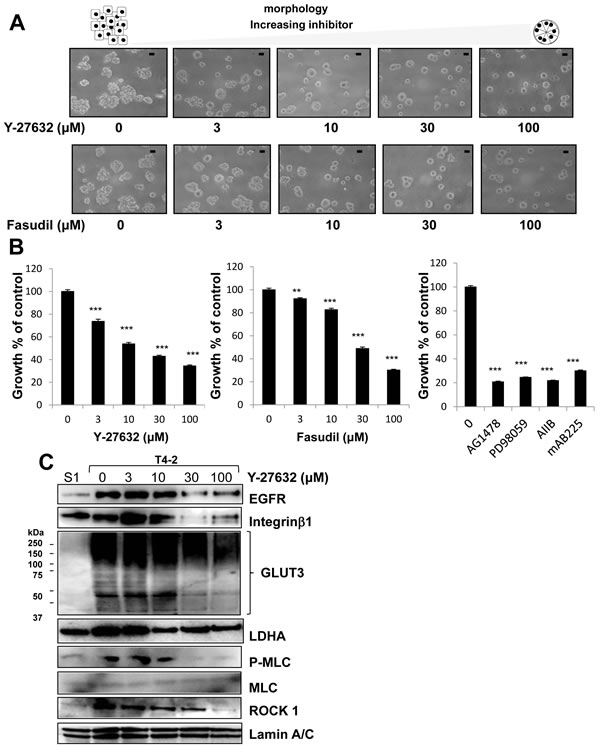 Involvement of ROCK in disorganized phenotype of malignant T4-2 cells in 3D lrECM.