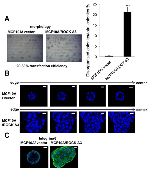Effects of overexpression of constructively active ROCK on nonmalignant MCF10A cells in 3D lrECM.