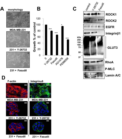 Involvement of ROCK in disorganized phenotype of MDA-MB-231 cells in 3D lrECM.