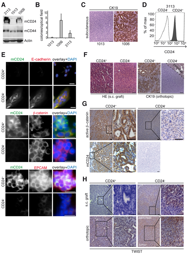 mCD24 expressing tumor cells lead to differentiated tumors.