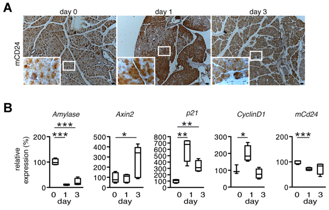 mCD24 expression in a mouse model for acute pancreatitis.