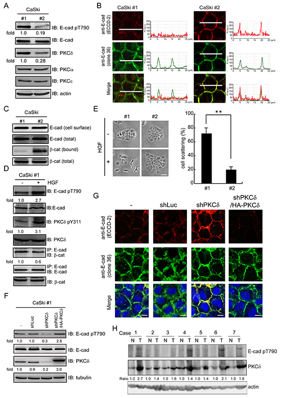 The expression of PKC&#x03B4; is correlated with Thr790 phosphorylation of E-cadherin in cervical carcinoma.