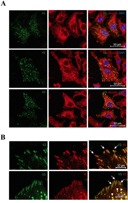 Subcellular localization of TNS2 isoforms.