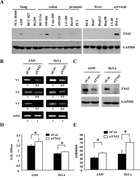 Silencing of TNS2 enhances cancer cell tumorigenicity.