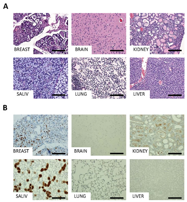 Detailed histology and characterization of MYB-NFIB mice.