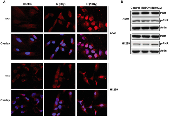 Subcellular localization and expression of PKR in A549 and H1299 cancer cells after radiation treatment.