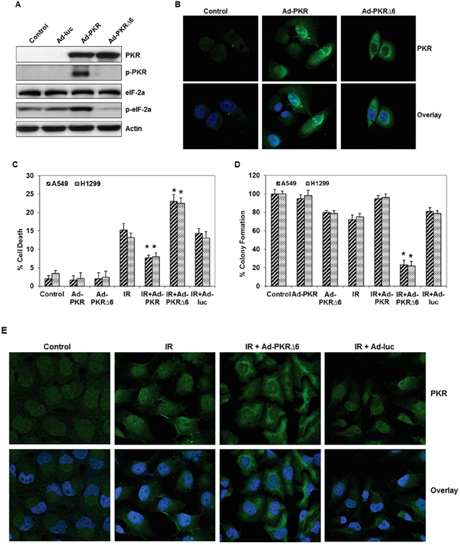 Adenoviral mutant PKR (Ad-PKR&#x0394;6) enhanced radiation-mediated cell death in lung cancer cells.