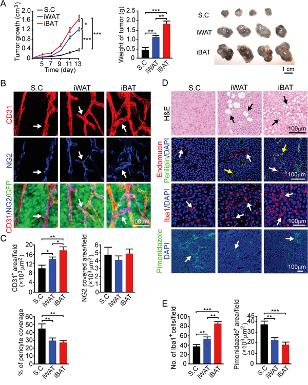 Growth rate, angiogenesis, microvessel, inflammation and tissue hypoxia of B16-F10 mouse melanoma tumors implanted in subcutaneous, iWAT and iBAT tissues.