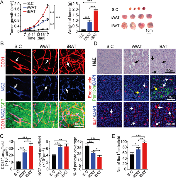 Growth rate, angiogenesis, microvessel and inflammation of T241 mouse fibrosarcoma tumors implanted in subcutaneous, iWAT and iBAT tissues.