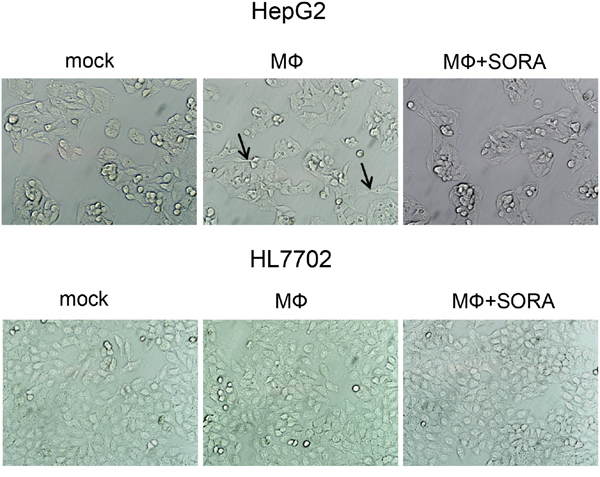 Sorafenib treatment counteracts polarized macrophage-induced EMT in HepG2 cells.