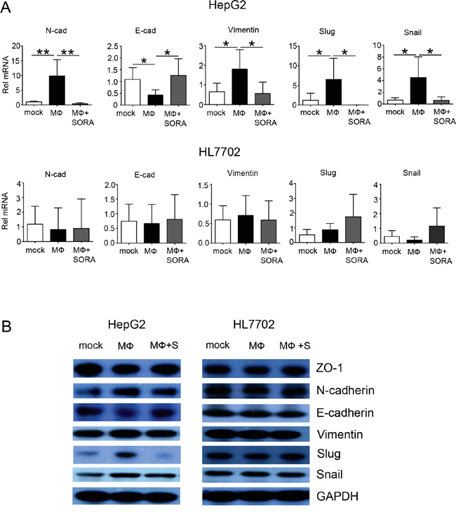 Sorafenib inhibits polarized macrophage-induced EMT-related gene and protein expression in HepG2 cells.