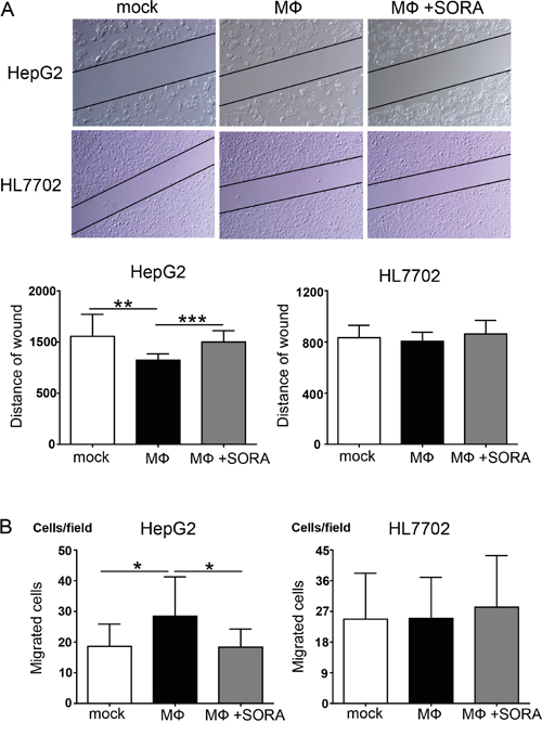 Polarized macrophages pretreated with sorafenib inhibit cellular migration of HepG2 cells.