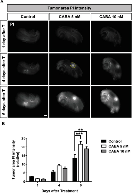 Cabazitaxel induces specifically tumor cell death in the brain microenviroment.