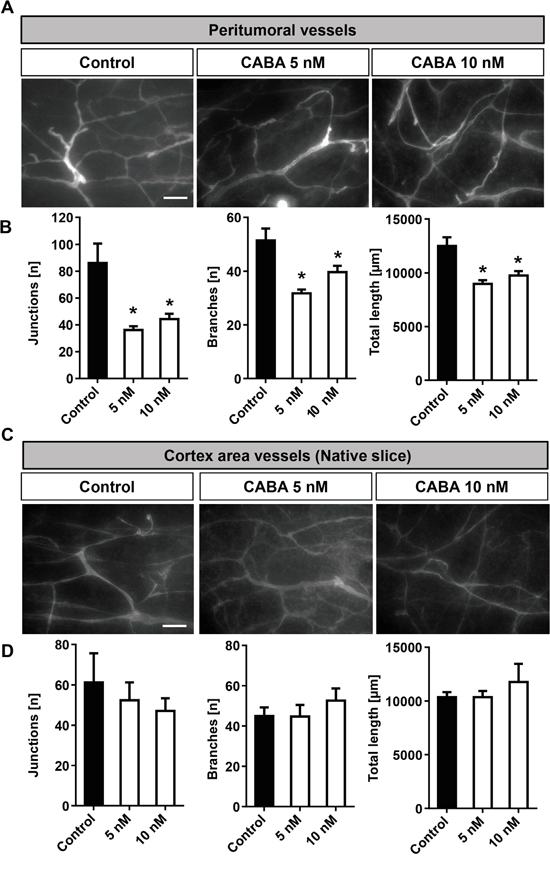 Cabazitaxel reduces tumor angiogenesis ex vivo.