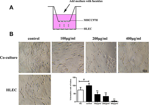 Fucoidan inhibits tumor-induced lymphangiogenesis in vitro.