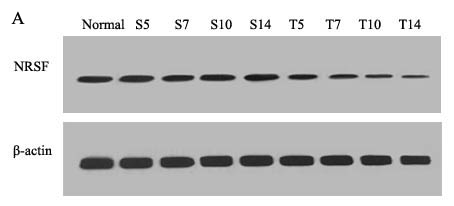 Mice spinal REST protein changes during the bone cancer pain.