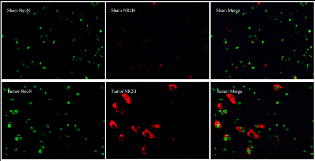 Immunofluorescence assays of localization of NR2B and REST protein in neurons using fluorescence microscope (original magnification&times;400).