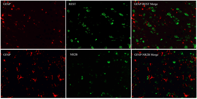 Immunofluorescence assays of the localization of NR2B and REST protein in astrocytes using fluorescence microscope (original magnification