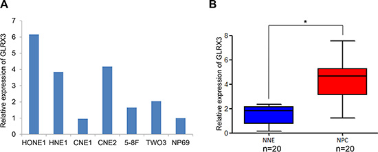 mRNA level of GLRX3 in nasopharyngeal carcinoma (NPC) and normal nasopharyngeal epithelia (NNE).