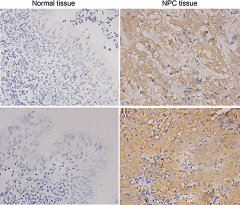 Immunohistochemical staining of GLRX3 protein expression in NPC (n = 59) and NNE tissue (n = 30).
