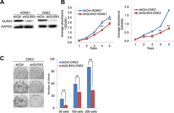 Knockdown of GLRX3 suppresses the growth of NPC cell line