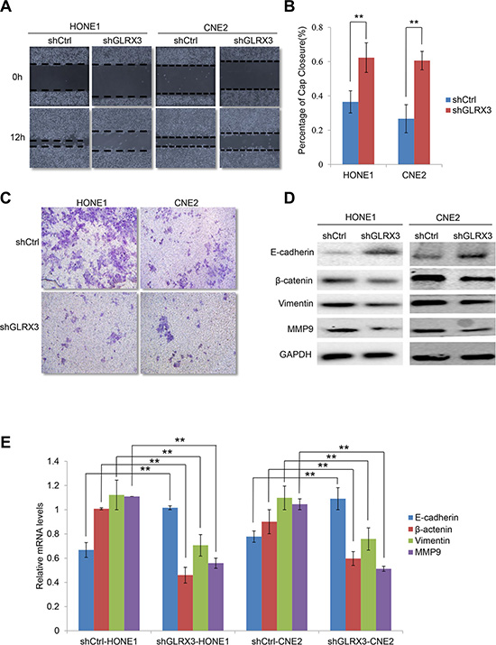Knockdown of GLRX3 inhibits migration and invasion of NPC cells.