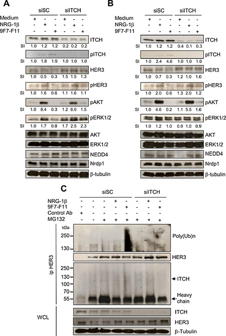 ITCH silencing inhibits 9F7-F11-mediated HER3 degradation and ubiquitination in cancer cells.