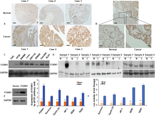 FOXK1 expression in CRC were higher than normal cells and increased multiple oncogenes expression.