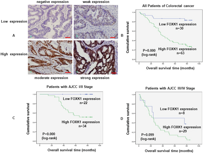 FOXK1 expression in CRC was associated with poor prognosis.