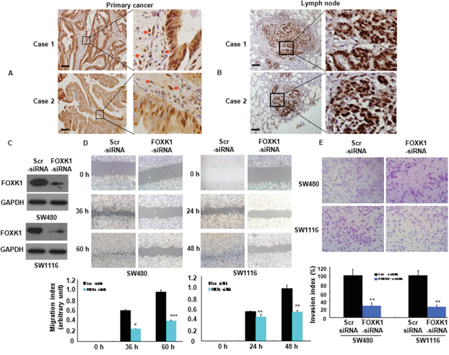 FOXK1 was associated with the invasive and metastatic potential of CRC.
