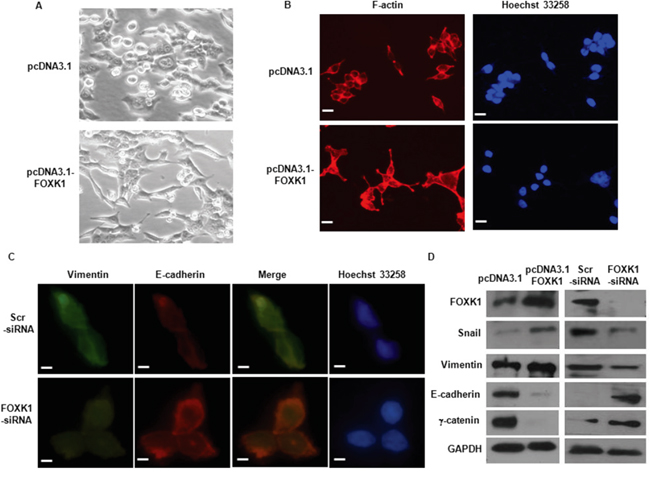 FOXK1 regulated epithelial-to-mesenchymal transition (EMT) in vitro.