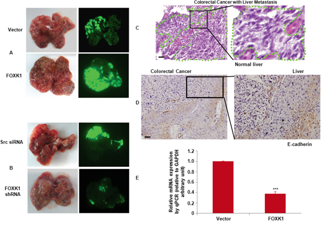 FOXK1 promoted tumour metastasis in vivo.
